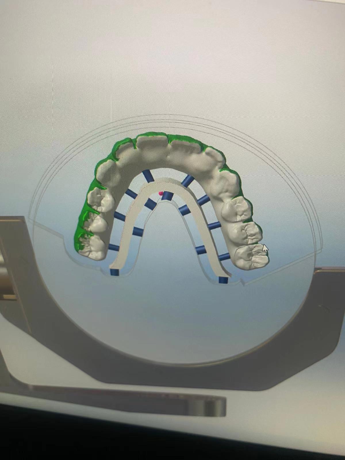 Zirconia1